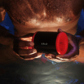 how to overcome sexual dysfunction with sex toys